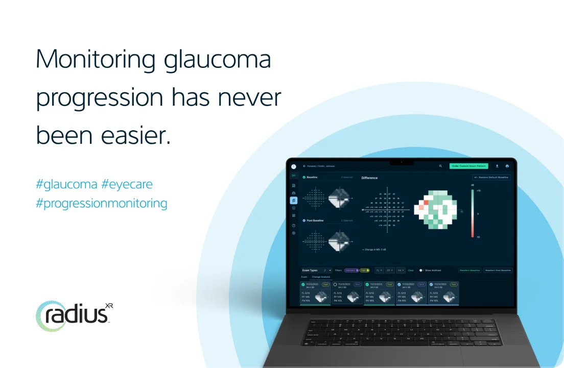 monitoring glaucoma progression